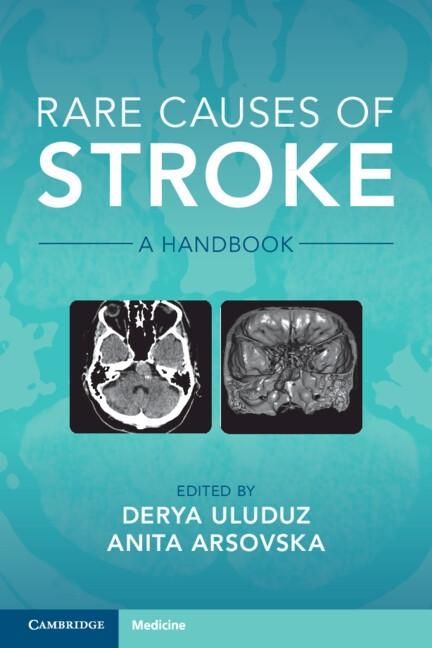 Produktbild: Rare Causes of Stroke