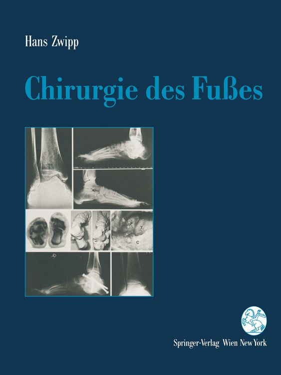 Produktbild: Chirurgie des Fu&szlig;es