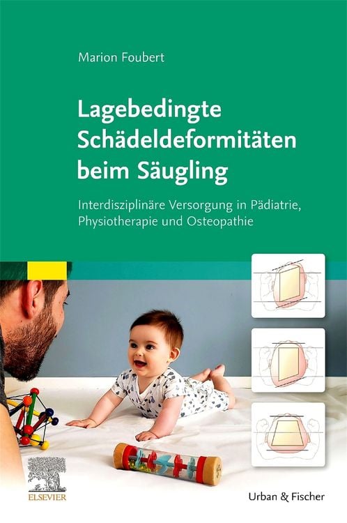 Produktbild: Lagebedingte Sch&auml;deldeformit&auml;ten beim S&auml;ugling