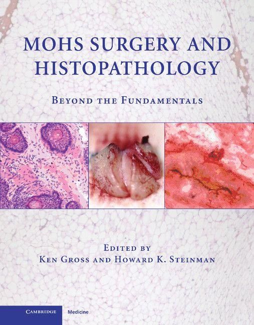 Produktbild: Mohs Surgery and Histopathology