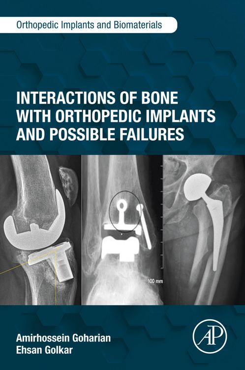 Produktbild: Interactions of Bone with Orthopedic Implants and Possible Failures