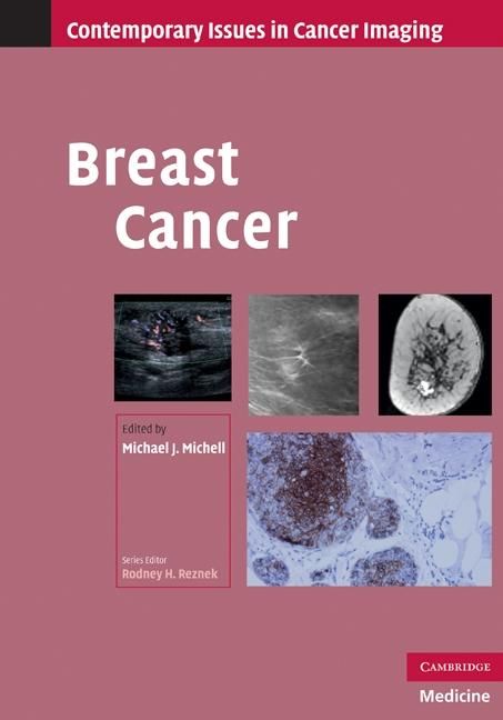 Produktbild: Breast Cancer