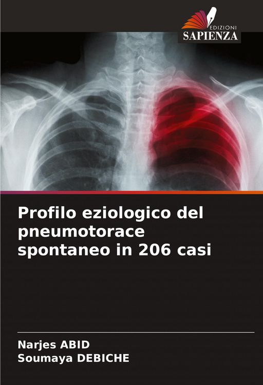 Produktbild: Profilo eziologico del pneumotorace spontaneo in 206 casi