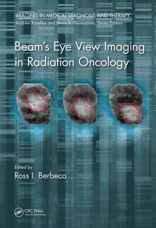 Produktbild: Beam's Eye View Imaging in Radiation Oncology