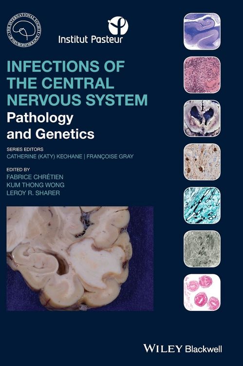 Produktbild: Infections of the Central Nervous System