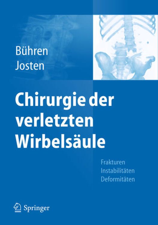 Produktbild: Chirurgie der verletzten Wirbels&auml;ule