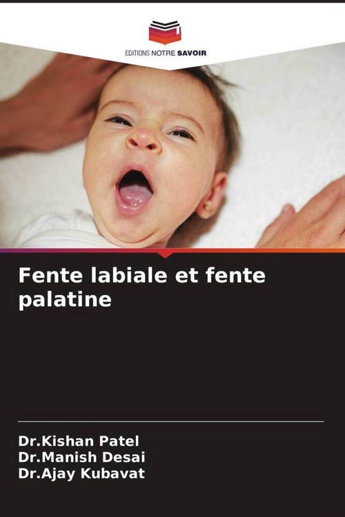 Produktbild: Fente labiale et fente palatine