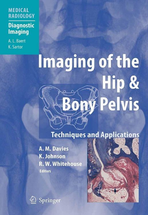 Produktbild: Imaging of the Hip & Bony Pelvis