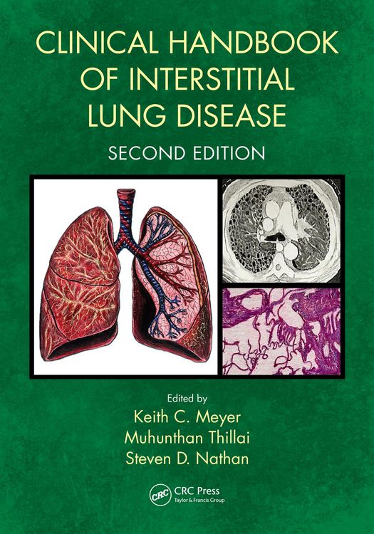 Produktbild: Clinical Handbook of Interstitial Lung Disease