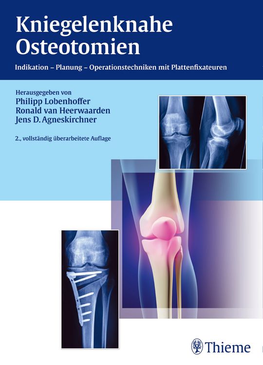 Produktbild: Kniegelenknahe Osteotomien