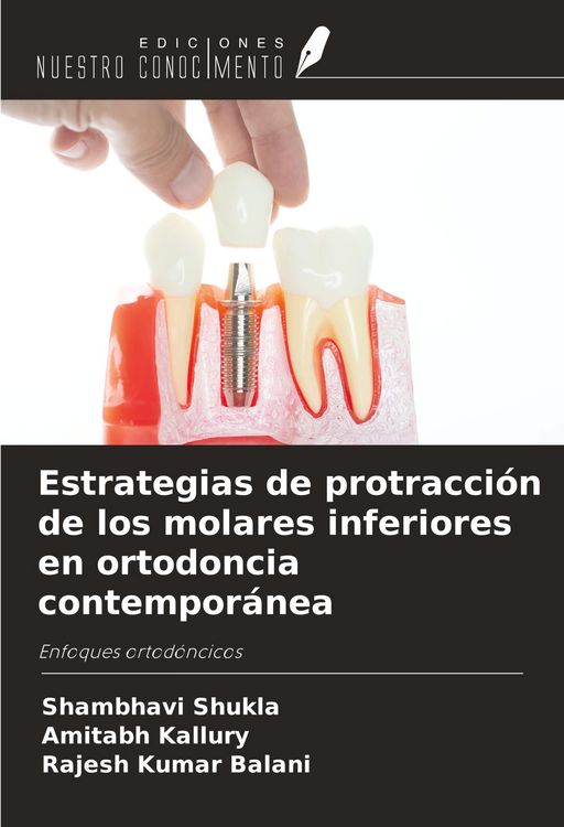 Produktbild: Estrategias de protracci&oacute;n de los molares inferiores en ortodoncia contempor&aacute;nea