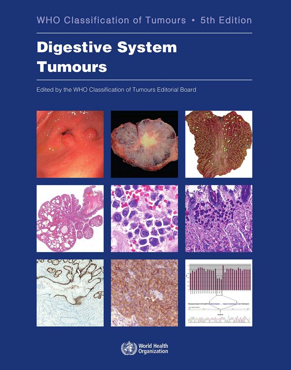 Produktbild: Digestive System Tumours