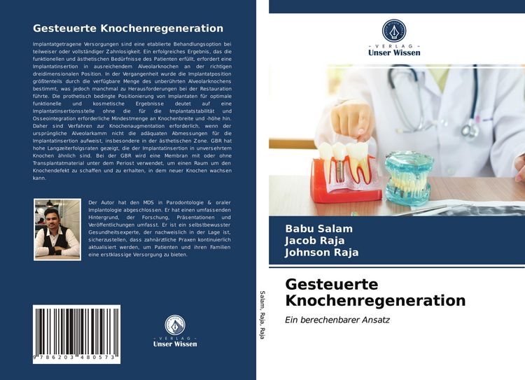 Produktbild: Gesteuerte Knochenregeneration