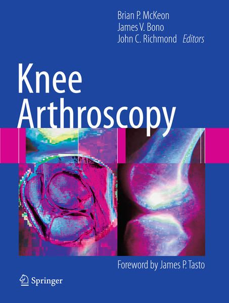 Produktbild: Knee Arthroscopy