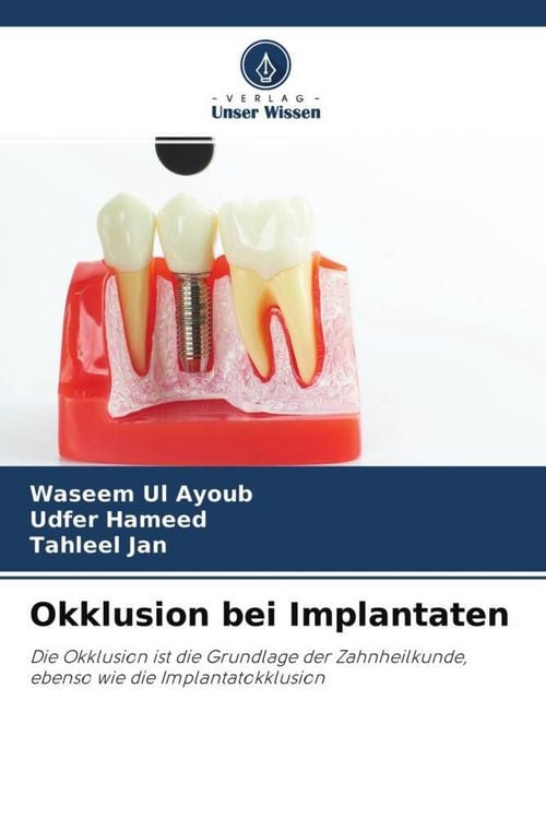 Produktbild: Okklusion bei Implantaten