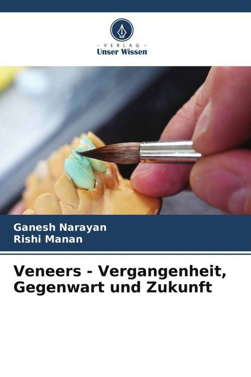 Produktbild: Veneers - Vergangenheit, Gegenwart und Zukunft