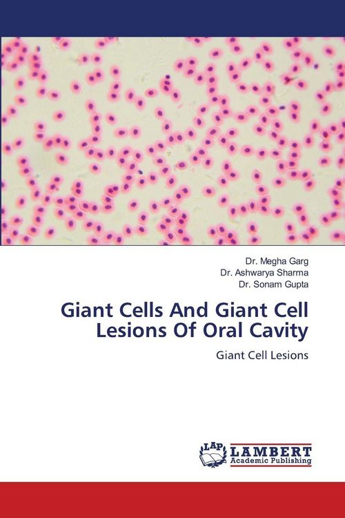 Produktbild: Giant Cells And Giant Cell Lesions Of Oral Cavity
