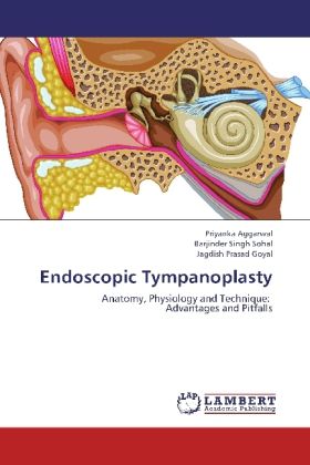 Produktbild: Aggarwal, P: Endoscopic Tympanoplasty