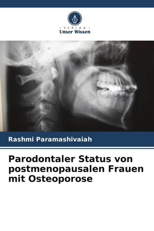 Produktbild: Parodontaler Status von postmenopausalen Frauen mit Osteoporose