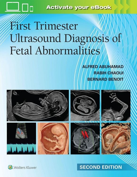 Produktbild: First Trimester Ultrasound Diagnosis of Fetal Abnormalities
