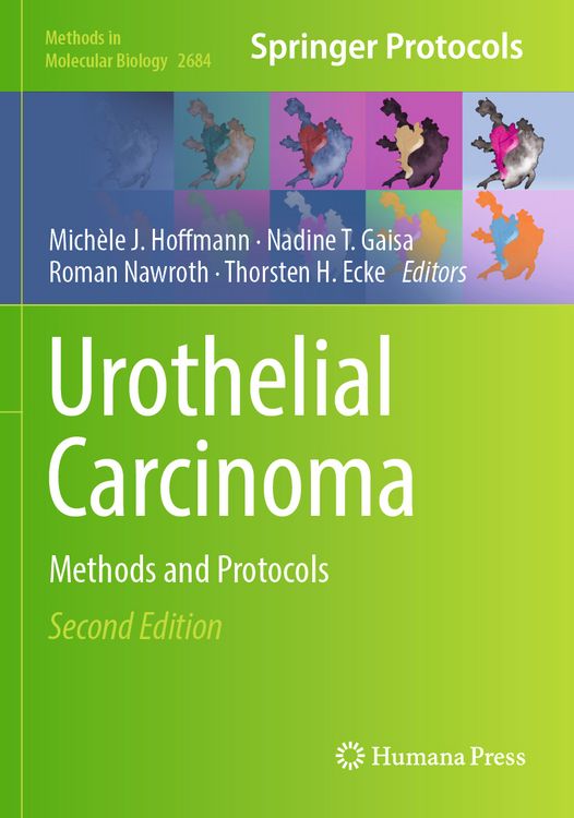 Produktbild: Urothelial Carcinoma