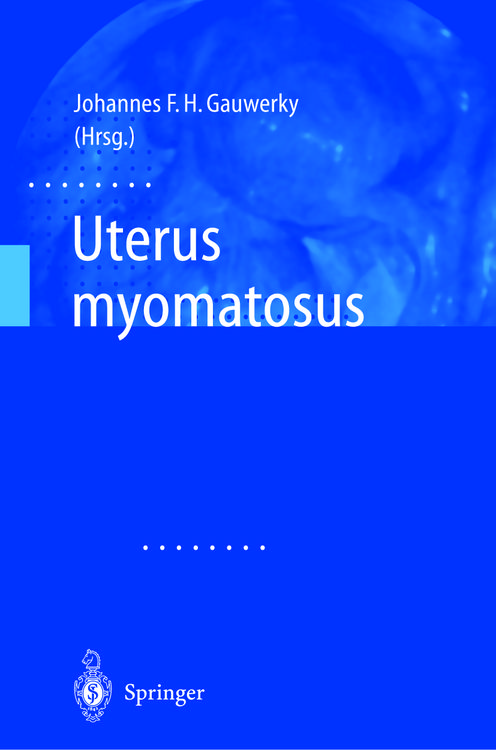 Produktbild: Uterus myomatosus