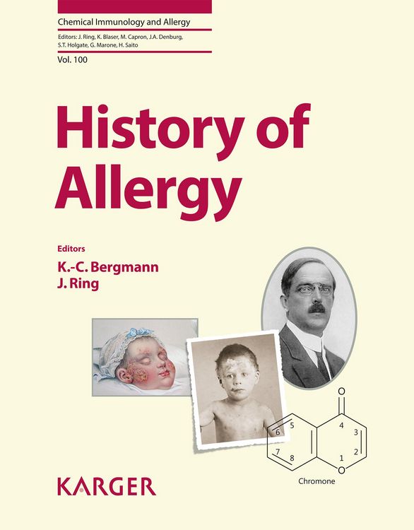 Produktbild: History of Allergy