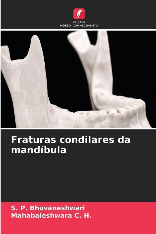Produktbild: Fraturas condilares da mand&iacute;bula