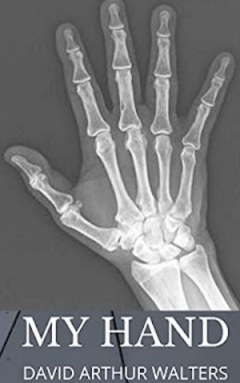 Produktbild: My Hand
