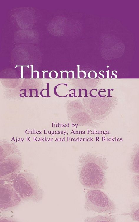 Produktbild: Thrombosis and Cancer