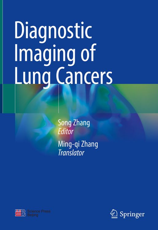 Produktbild: Diagnostic Imaging of Lung Cancers