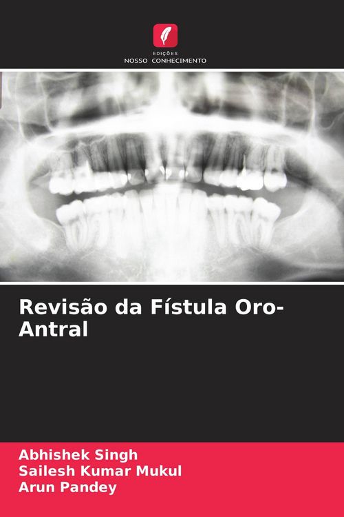 Produktbild: Revis&atilde;o da F&iacute;stula Oro-Antral