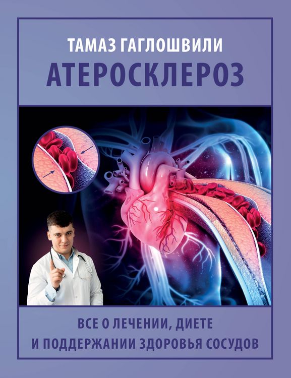 Produktbild: Ateroskleroz. Vse o lechenii, diete i podderzhanii zdorovya sosudov