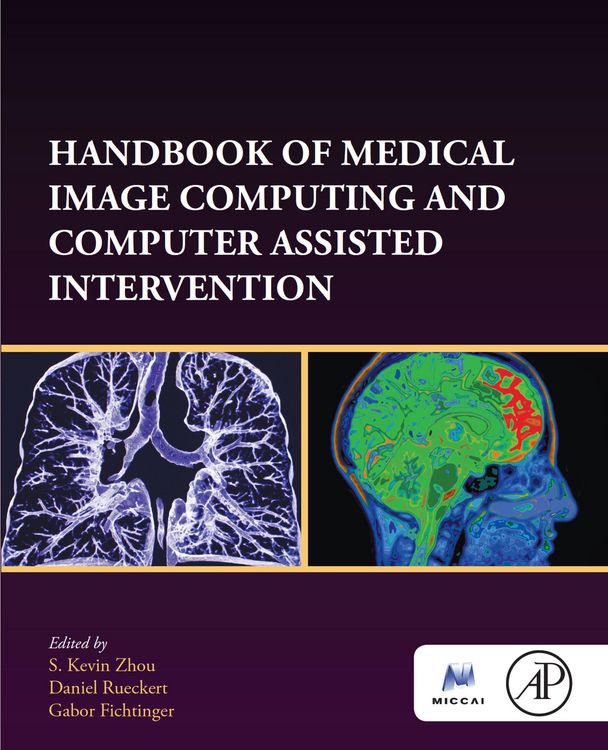 Produktbild: Handbook of Medical Image Computing and Computer Assisted Intervention