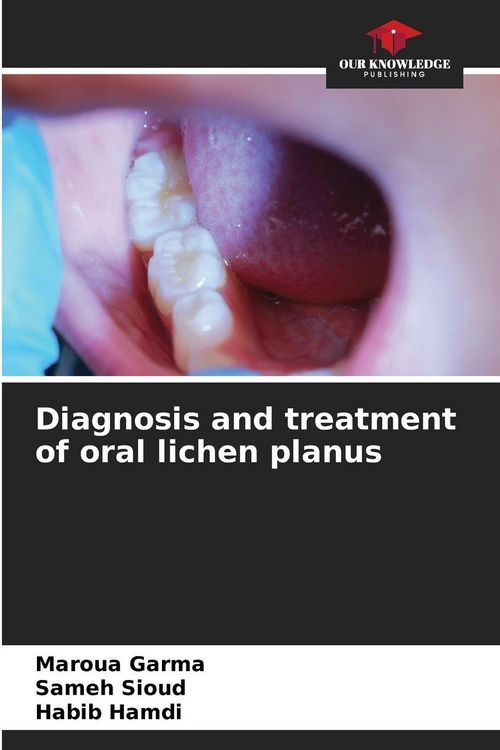 Produktbild: Diagnosis and treatment of oral lichen planus