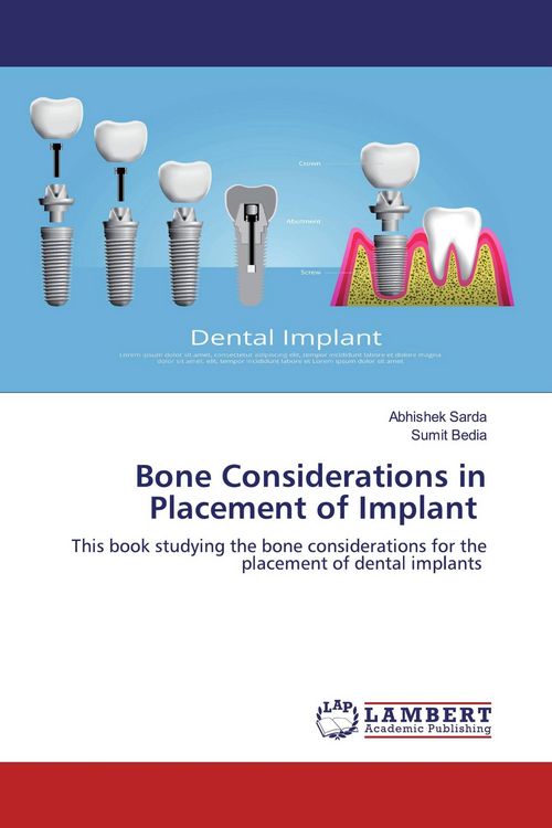 Produktbild: Bone Considerations in Placement of Implant