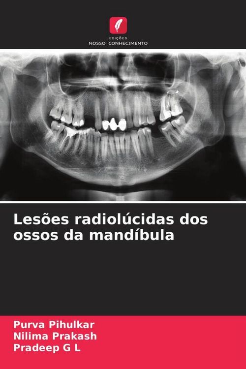 Produktbild: Les&otilde;es radiol&uacute;cidas dos ossos da mand&iacute;bula