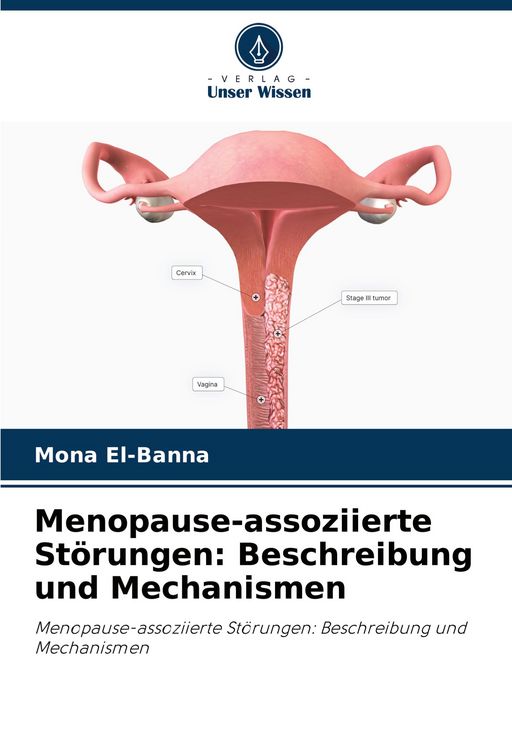 Produktbild: Menopause-assoziierte St&ouml;rungen: Beschreibung und Mechanismen