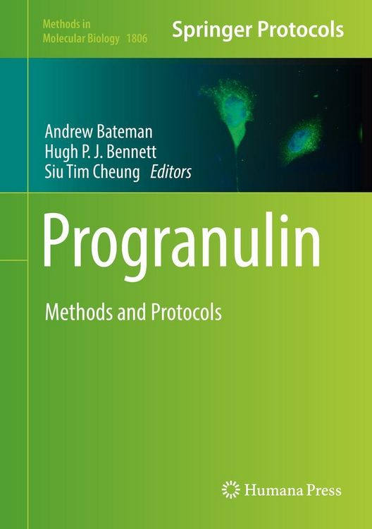 Produktbild: Progranulin