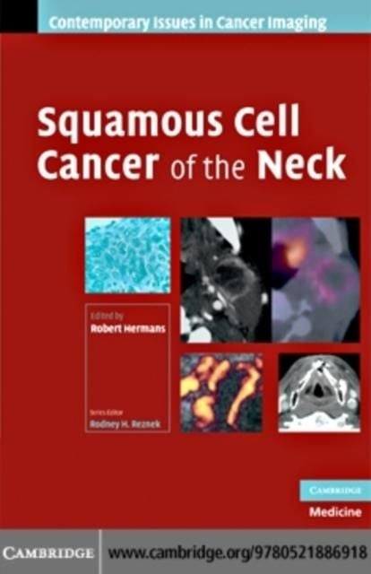 Produktbild: Squamous Cell Cancer of the Neck