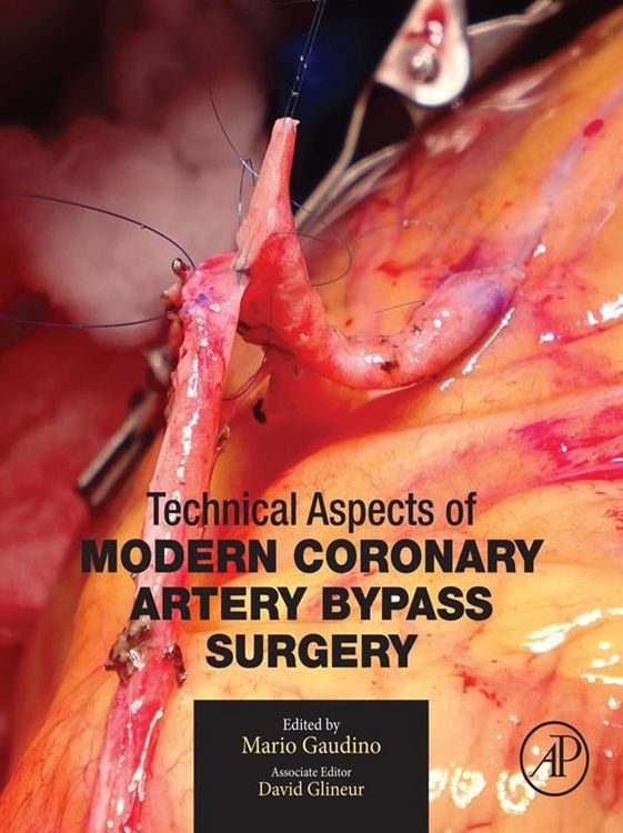 Produktbild: Technical Aspects of Modern Coronary Artery Bypass Surgery