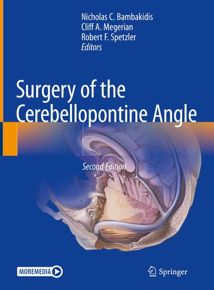Produktbild: Surgery of the Cerebellopontine Angle