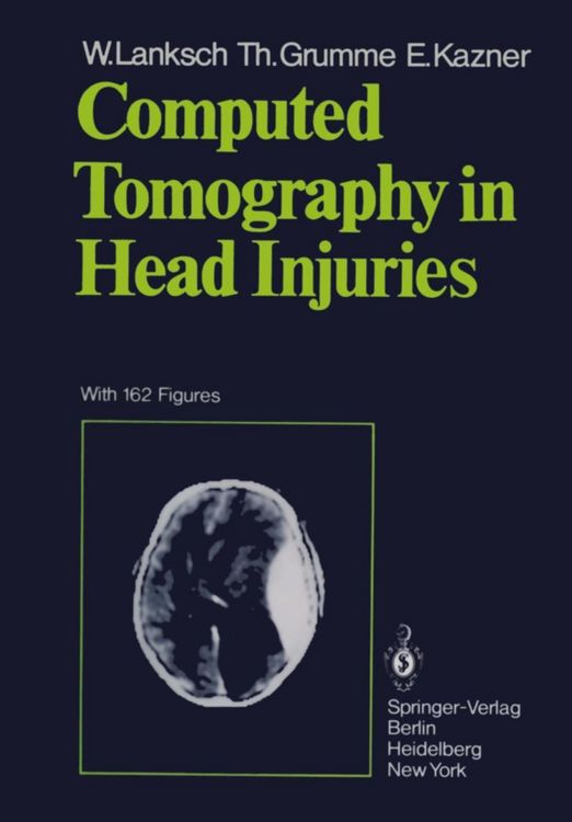 Produktbild: Computed Tomography in Head Injuries