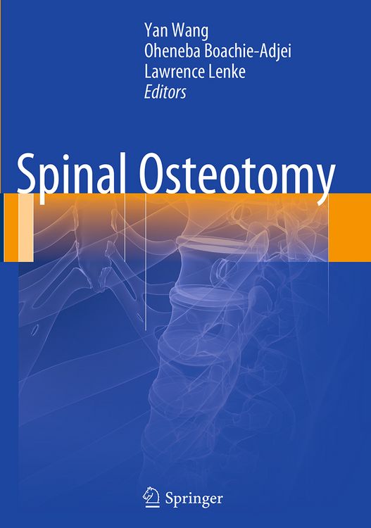 Produktbild: Spinal Osteotomy