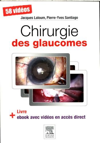 Produktbild: Chirurgie des glaucomes