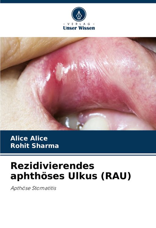 Produktbild: Rezidivierendes aphth&ouml;ses Ulkus (RAU)
