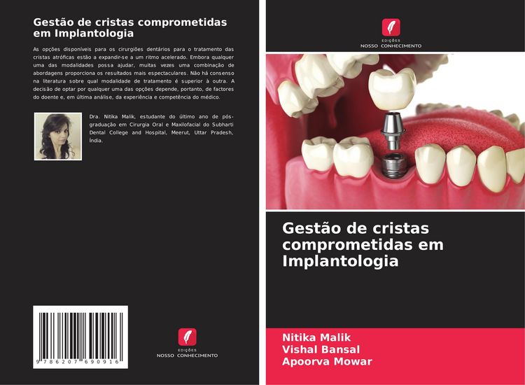 Produktbild: Gest&atilde;o de cristas comprometidas em Implantologia