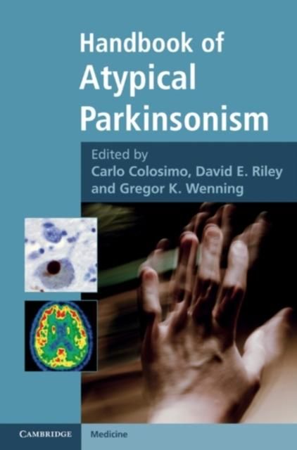 Produktbild: Handbook of Atypical Parkinsonism