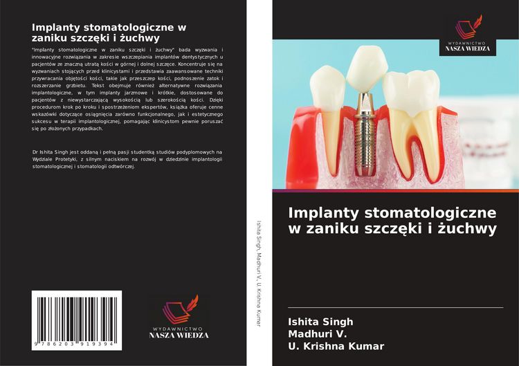 Produktbild: Implanty stomatologiczne w zaniku szcz&iquest;ki i &iquest;uchwy
