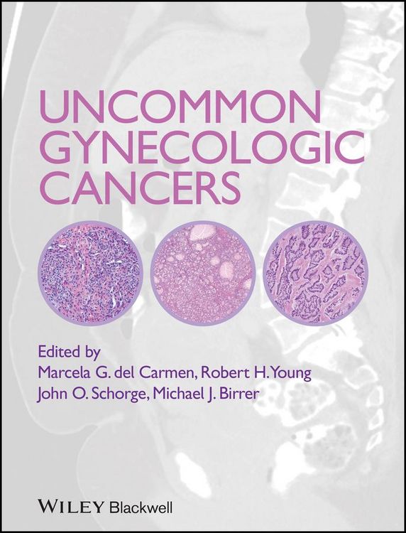 Produktbild: Uncommon Gynecologic Cancers